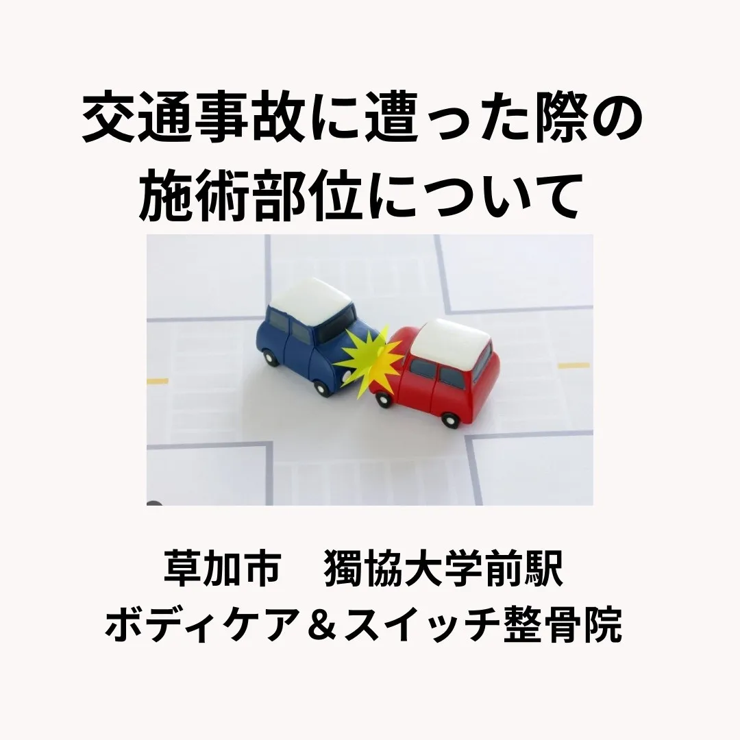 交通事故に遭った際の施術部位について。