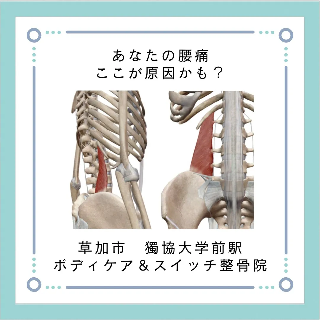 あなたの腰痛ここが原因かも？